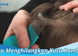 Cara Menghilangkan Kutu Rambut Dan Telurnya Secara Alami Tanpa Merusak Rambut